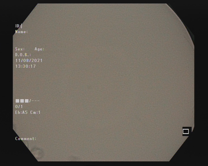 gal_Filter faults_17