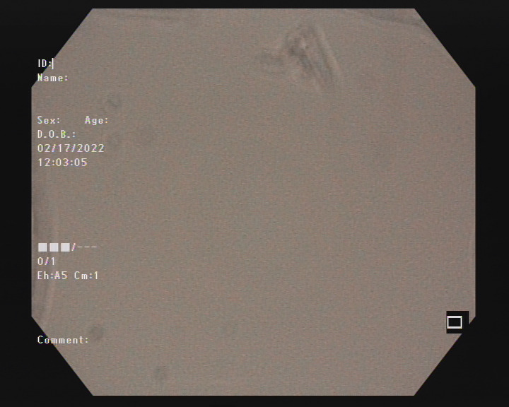 gal_Filter_faults_24
